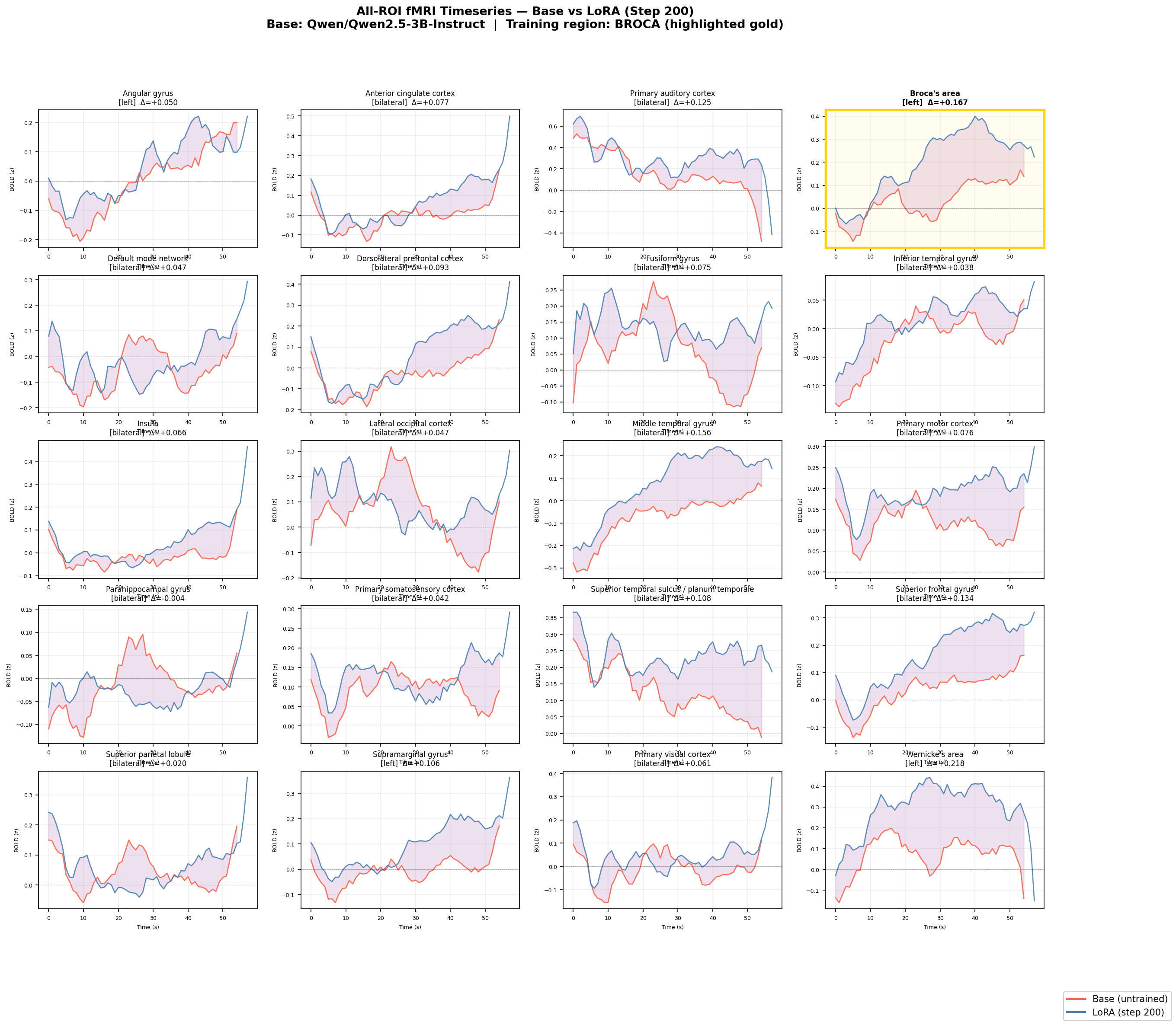 All ROI timeseries